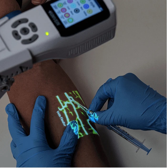  Vein Finder